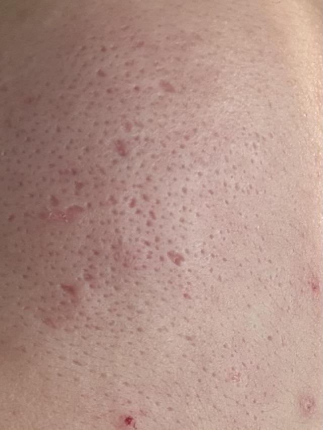 review_image