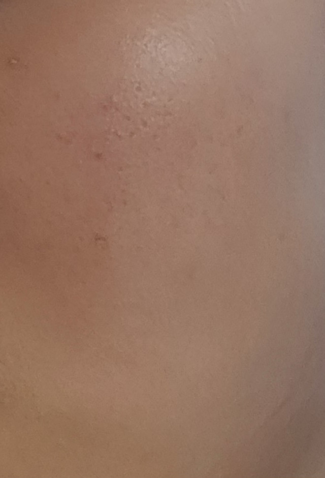 review_image
