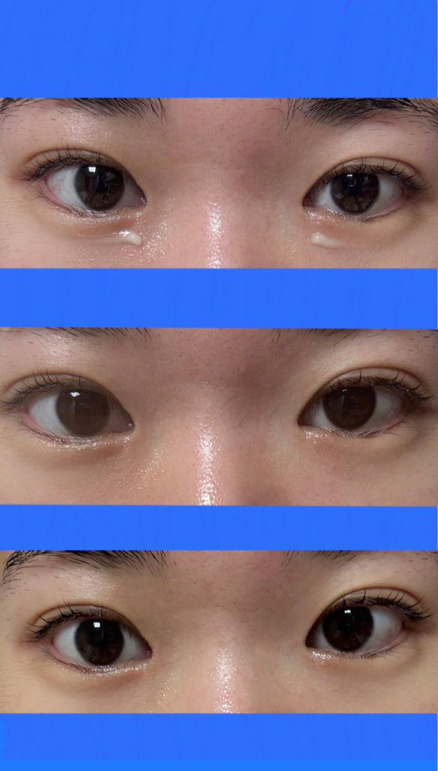 review_image