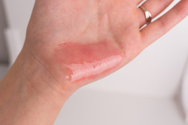 review_image