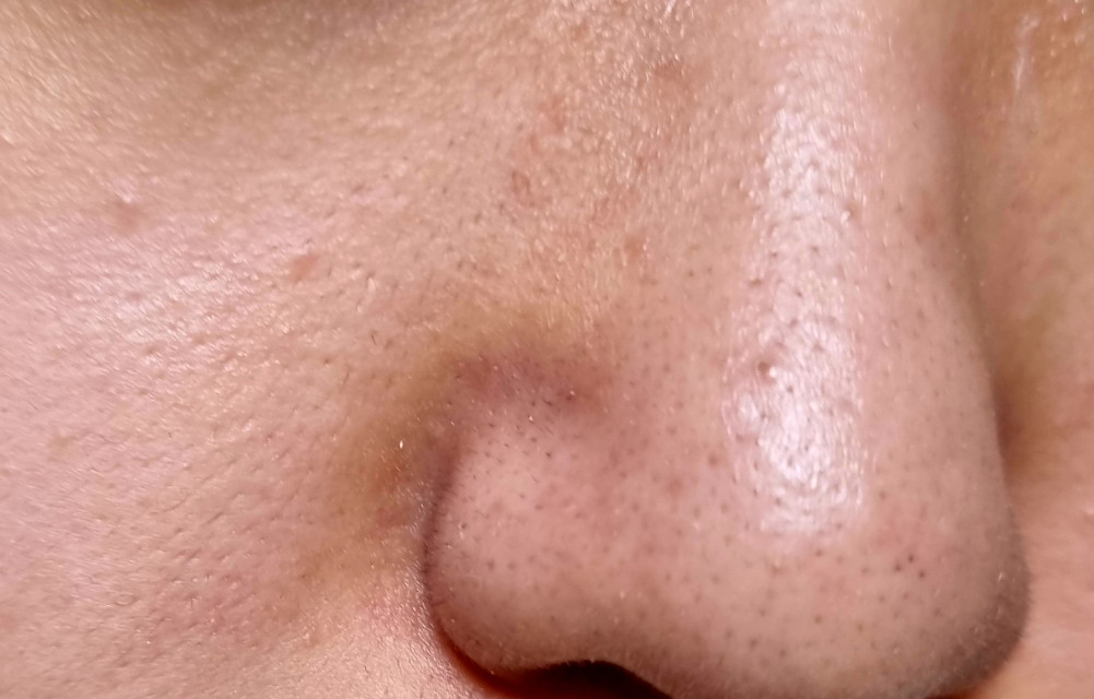 review_image